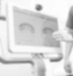 itero scanner yp ortho