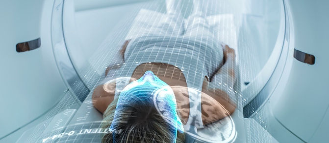 Intelligenza artificiale per RM