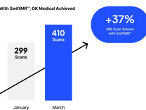 SwiftMR™ riduce i tempi di scansione. Illusione o concretezza?