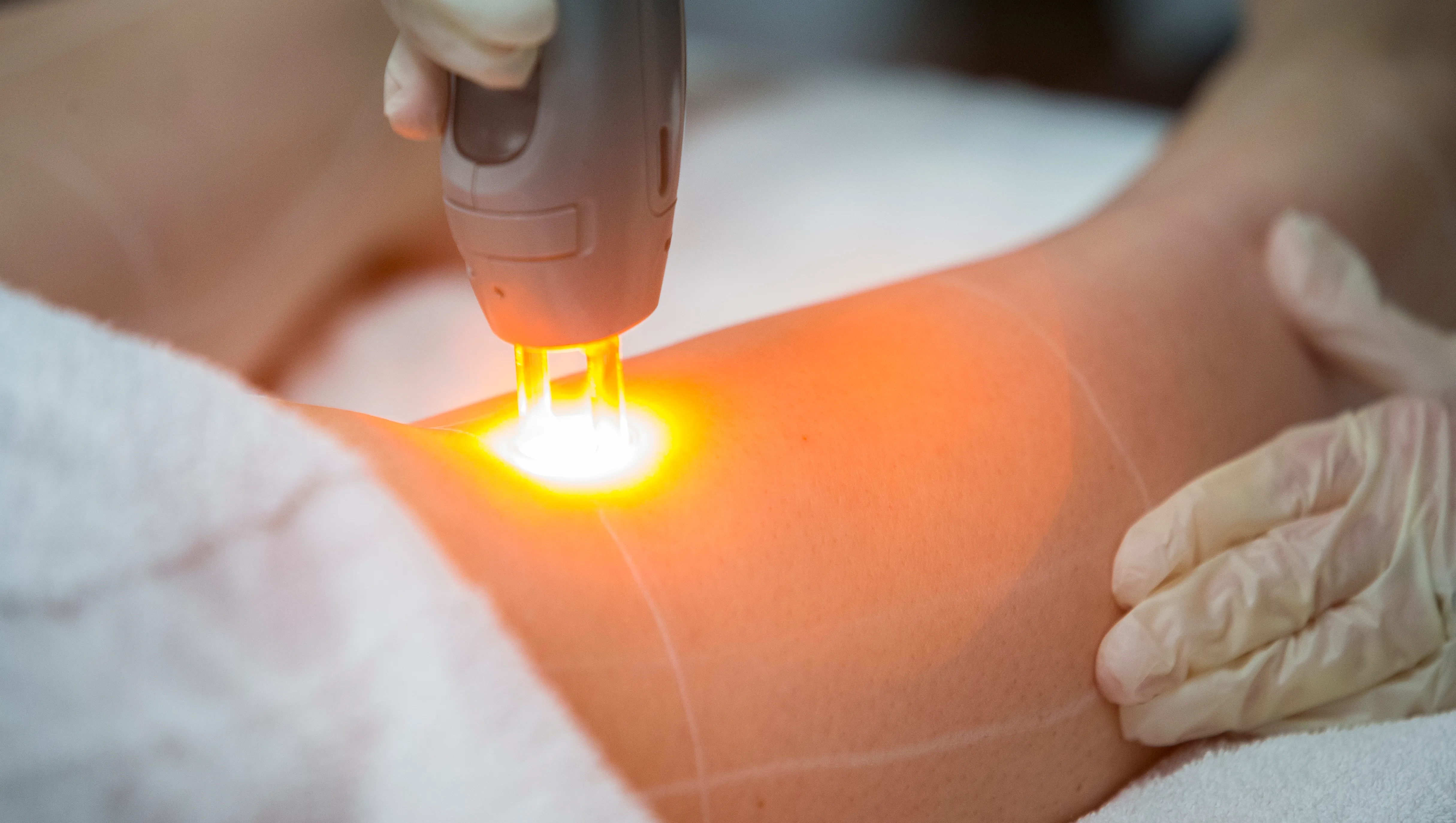 Laser Hair Removal Heavenly Oasis laser-hair-removal-heavenly-oasis