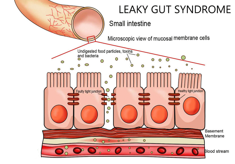 intestino leaky.gif