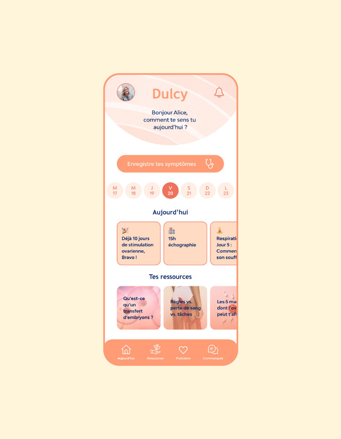mobile