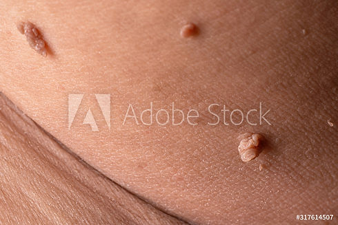 AdobeStock_317614507_Preview.jpeg