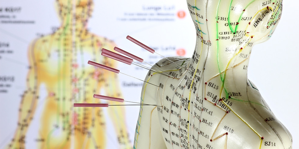 Acupuncture Can Change Your Life