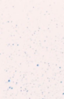 Pink Speckled Abstract Pattern_edited.jp