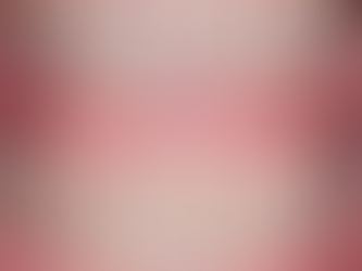 삐뚤어진 아래 앞니 에어라인 교정으로 편안하게 교정했어요.