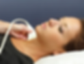 Carotid IMT