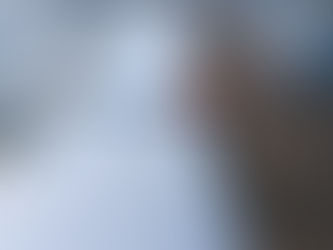 The Ugly Truth: How Smoking Impacts Your Oral Health and Teeth