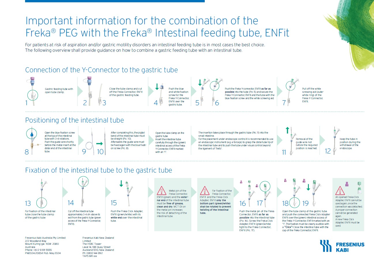How to connect the Freka PEG or Freka PEG Pro to the Freka intestinal tube