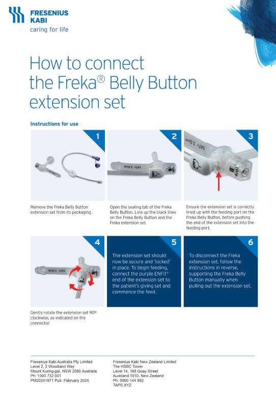 Freka Belly Button - How to connect the extension sets