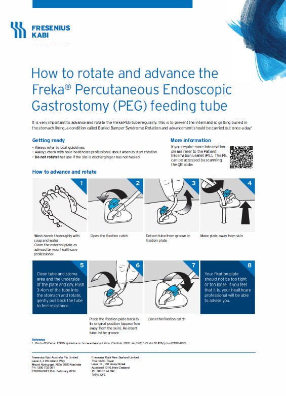 Freka PEG's - How to advance and rotate the PEG once inserted