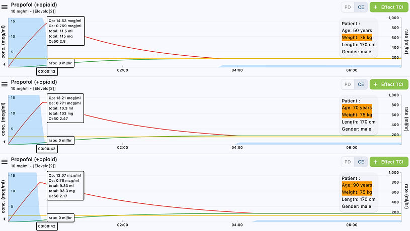 Eleveld + Opioids 50 yr 70 yr 90 yr at 75 kg and 170 cm at 42 secs.jpg