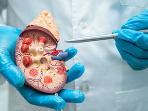 Idratazione e calcoli renali: quanto bere davvero