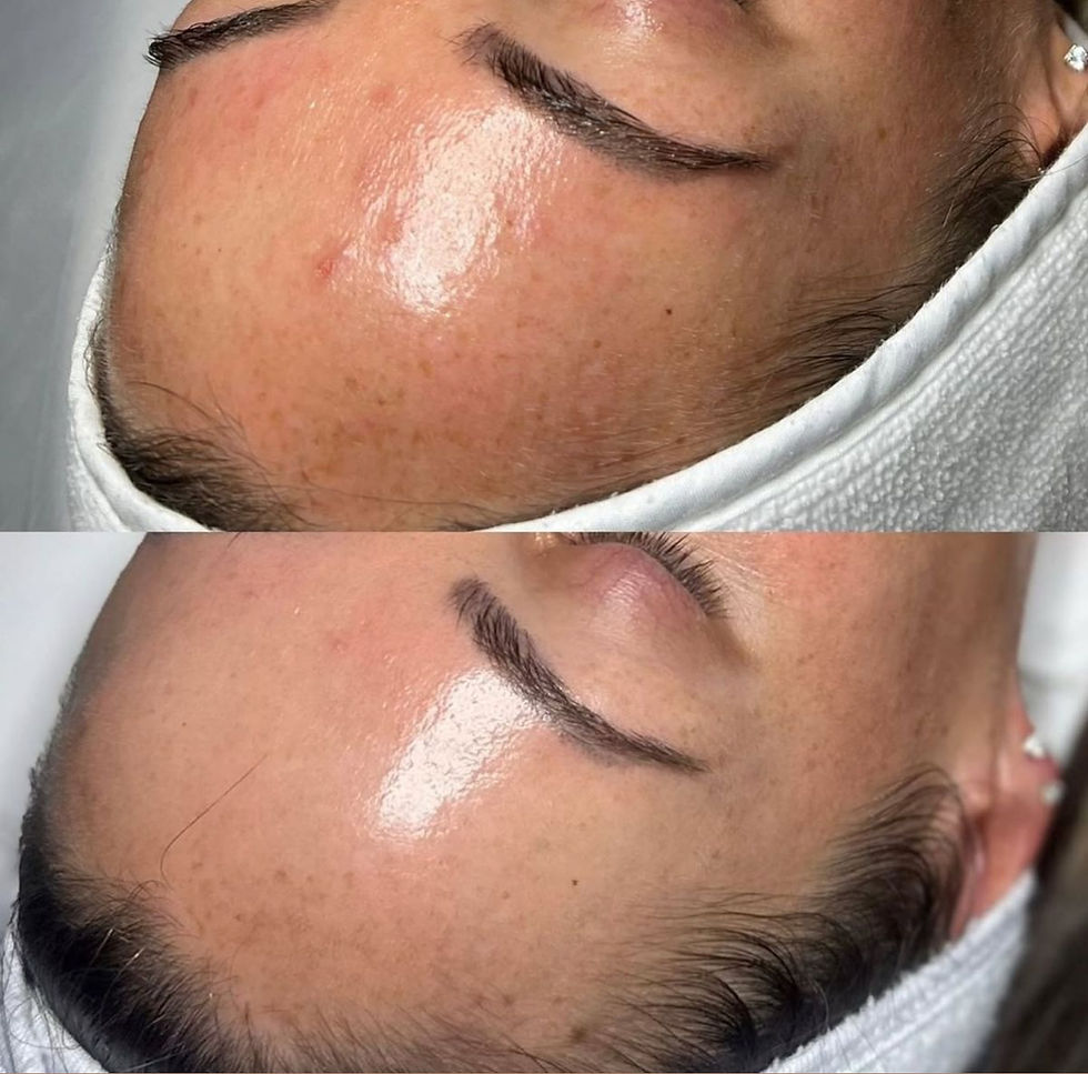 What to Expect: How Long Do Beauty Treatment Results Really Last?