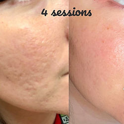 Best facial Basingstoke