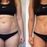 Rediscover Your Silhouette: Effortless Body Sculpting with Zero Downtime