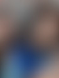 Dismorfia de Snapchat: más allá de simples filtros