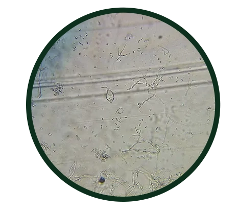 Phytophthora.webp