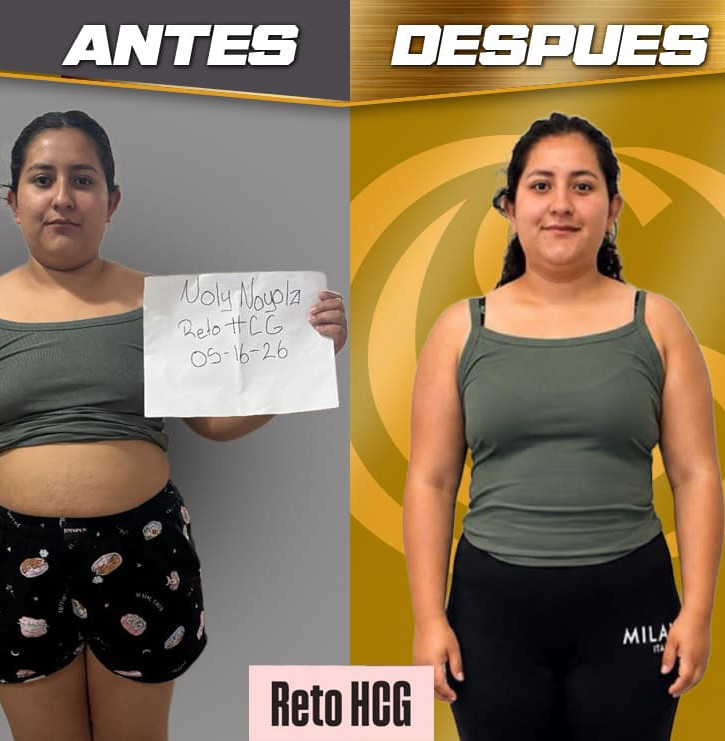 Antes y despues OK 8 copy.jpg