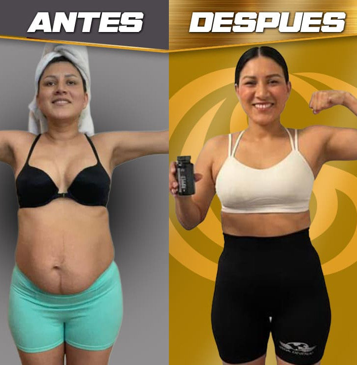 Antes y despues OK 5.jpg