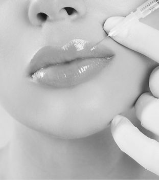 lip-filler_edited.jpg