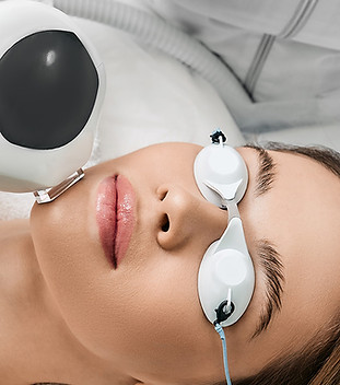 IPL-photofacial-treatment-1600x732_gbxqSmk.jpg