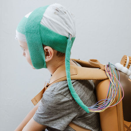 How To Use The Event Button During Your Long-Term EEG