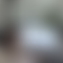 Brain or Heart? How EEG Plays a Roll in Fainting vs Seizures