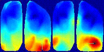 Seed pixel correlation map