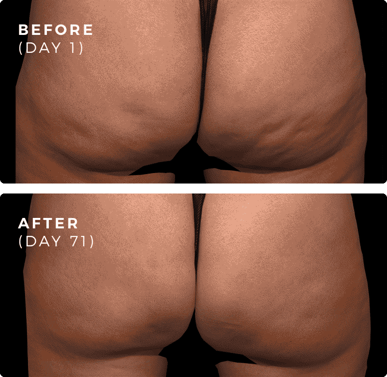 1_1_BA_Patient1_1_reduced_20_loss-min.gi