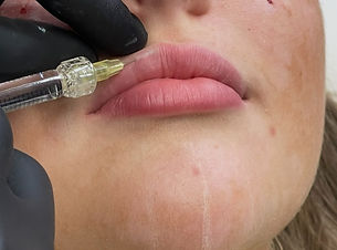 lips_edited.jpg
