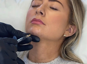 Chin Filler_edited.jpg