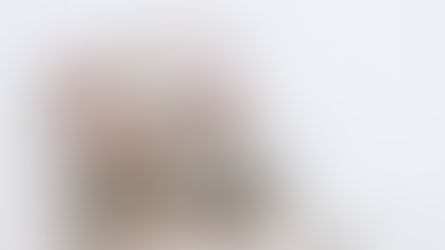 Acupuncture or Pin Cushion Time  