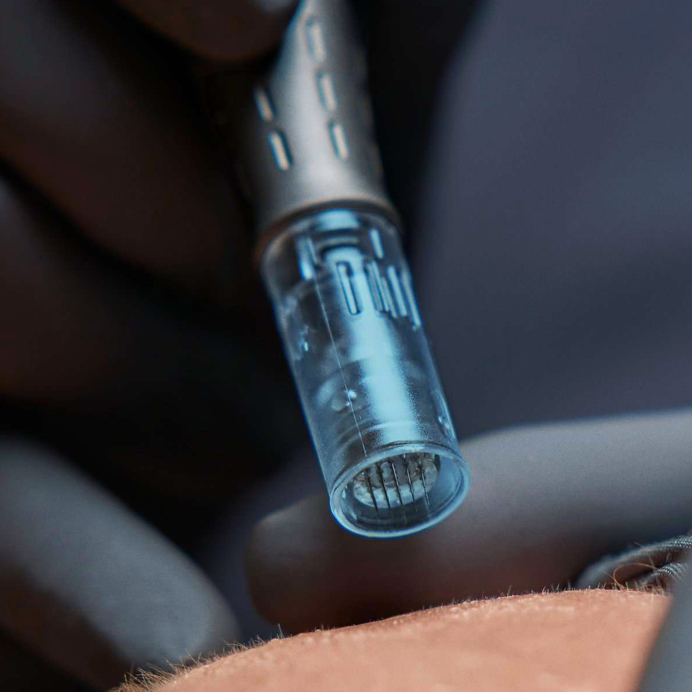 microneedling pen application on client