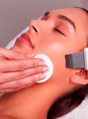 CACI peeler