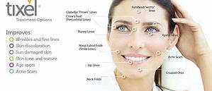Tixel-Treatment-Options.jpeg