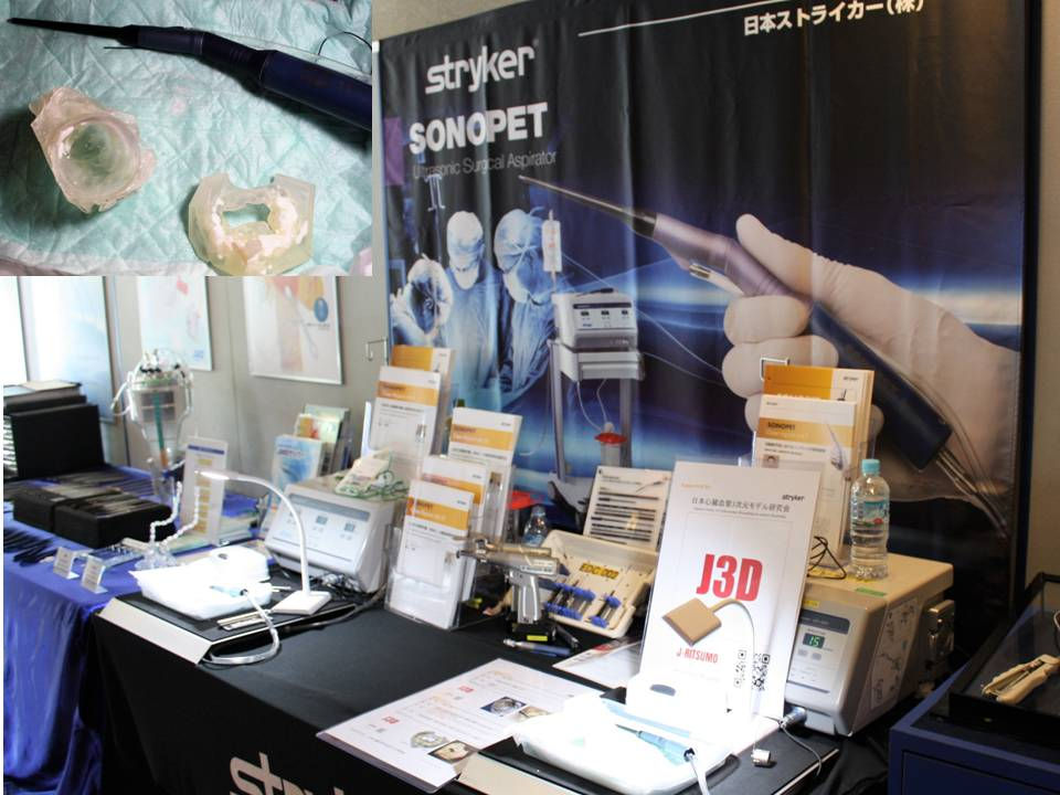 日本ストライカー株式会社の石灰化組織除去の実演にj3dライセンスモデル 石灰化僧帽弁mac 石灰化大動脈弁 が使用されました 日本ストライカー株式会社の石灰化組織除去の実演にj3dライセンスモデル 石灰化僧帽弁mac 石灰化大動脈弁 が使用されました