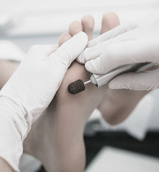 foot and nail care podiatrist rouse hill town centre