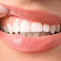 Abarca Dental- All rights reserved (1)_edited.png