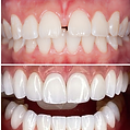 Abarca Dental- All rights reserved