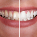 Abarca Dental- All rights reserved (2).png