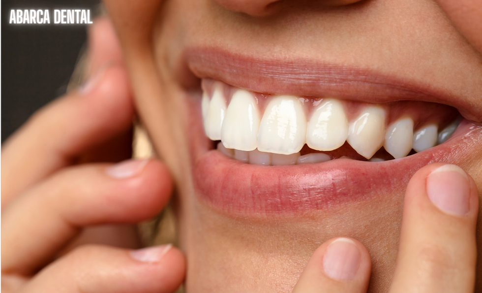 Tu Salud Oral en Buenas Manos Con Abarca Dental "Escultores de Sonrisas"