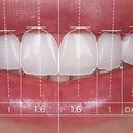 Abarca Dental- All rights reserved.png
