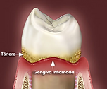 Periodontia