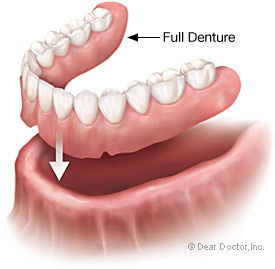 Dentadura