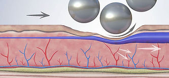 5 Actions - Lymphatic Drainage