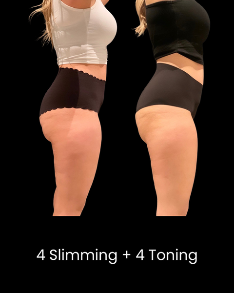 Cryoskin Slimming Before and After