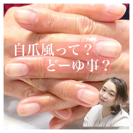 自爪風って何？