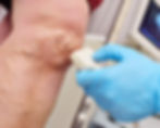 An ultrasound tech scanning someone's legs with varicose veins.