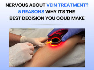 Nervous About Vein Treatment? Here Are 5 Reasons Why It's the Best Decision You Could Make